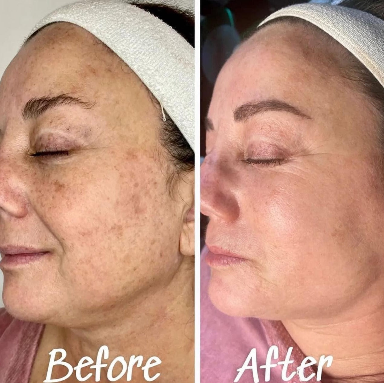 Clear Skin Collective Pigment Perfect Tone Correcting Serum