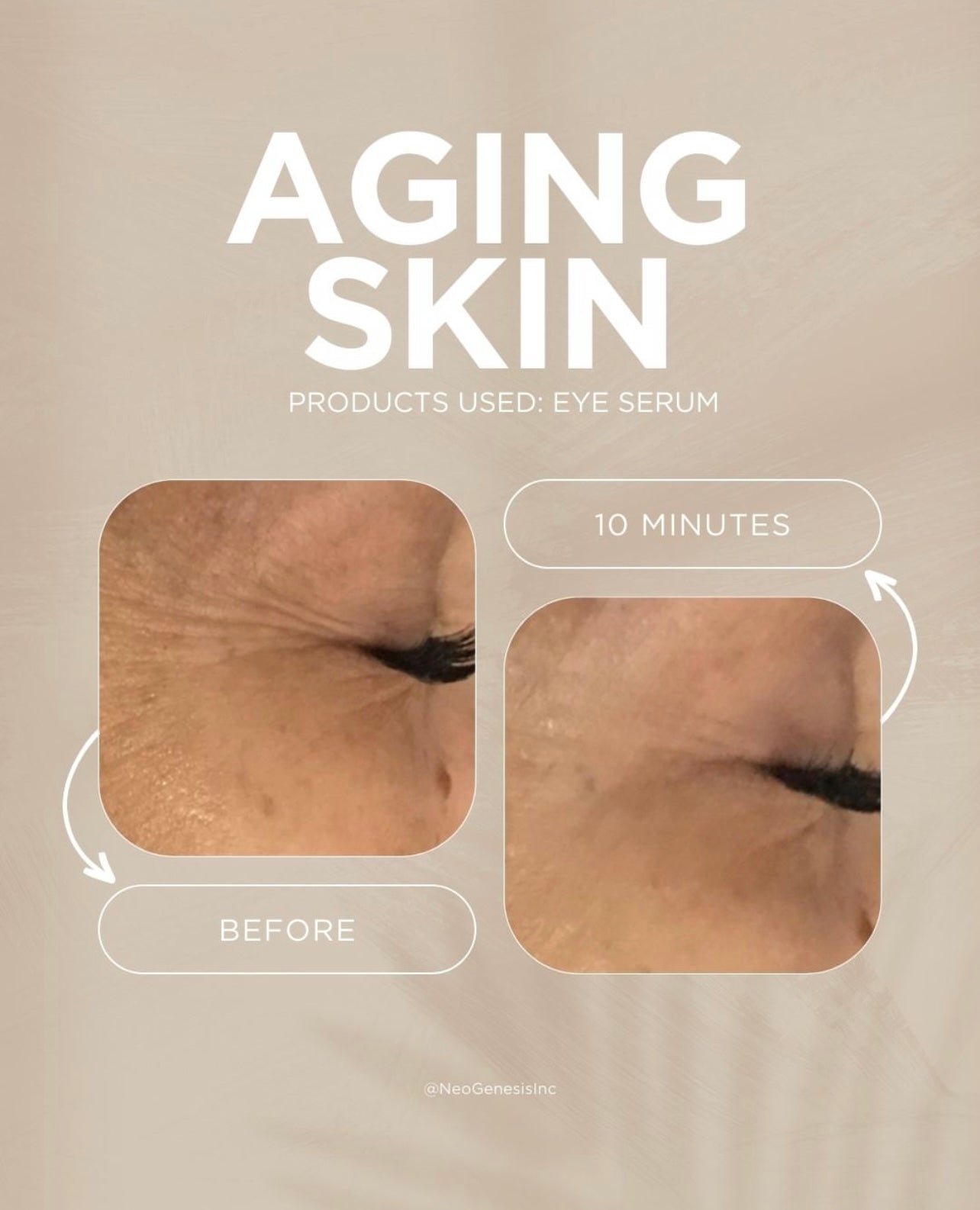 NeoGenesis - EYE SERUM