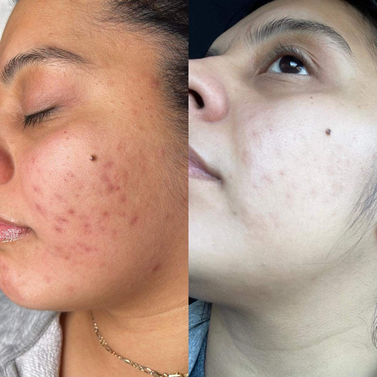 Clear Skin Collective Pigment Perfect Tone Correcting Serum