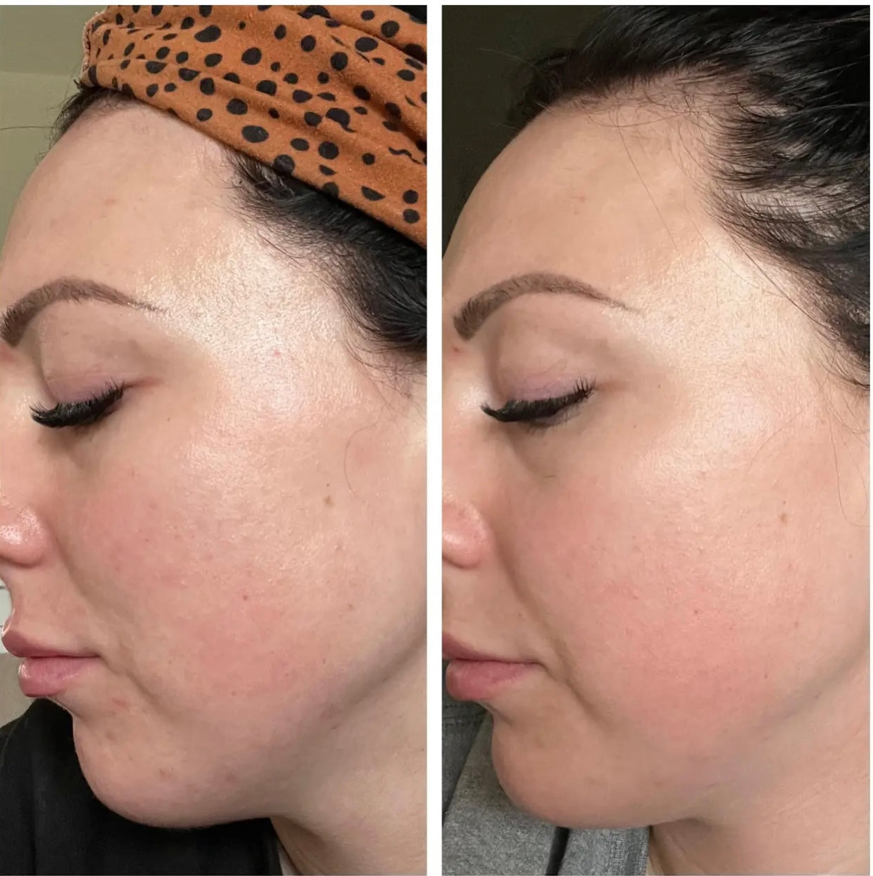 Circadia Serum 71
