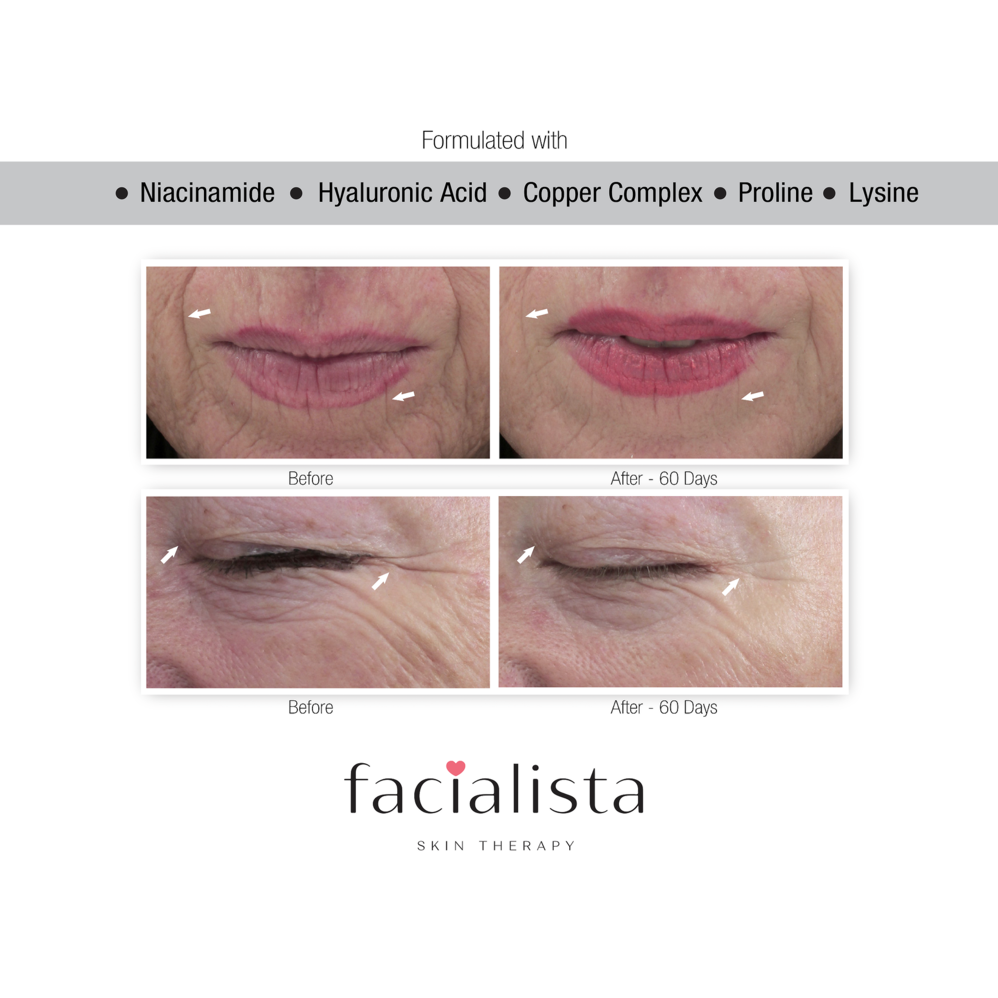 Facialista Bye Bye Botox 1 oz